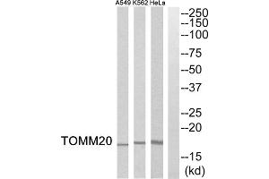 Western blot analysis of extracts from HeLa cells, K562 cells and A549 cells, using TOMM20 antibody. (TOMM20 抗体  (Internal Region))