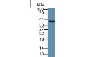 Western Blot; Sample: Human Jurkat cell lysate; Primary Ab: 1µg/ml Rabbit Anti-Human HMG20B Antibody Second Ab: 0. (HMG20B 抗体  (AA 27-213))