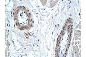 Formalin-fixed and paraffin embedded human heart tissue labeled with Anti-PAX7 Polyclonal Antibody, Unconjugated (ABIN739905) followed by conjugation to the secondary antibody (PAX7 抗体  (AA 410-460))