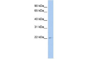 WB Suggested Anti-TUSC1 Antibody Titration: 0. (TUSC1 抗体  (Middle Region))