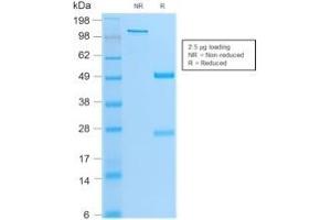 SDS-PAGE Analysis Purified MyoD1 Mouse Monoclonal Antibody (MYOD1/2075R). (Recombinant MYOD1 抗体)