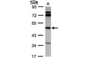 WB Image Sample(30 ug whole cell lysate) A:Hep G2 , 10% SDS PAGE antibody diluted at 1:1000 (BHMT 抗体)