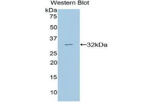 Detection of DGKa in Recombinant Diacylglycerol Kinase Alpha, Rat using Polyclonal Antibody to Diacylglycerol Kinase Alpha (DGKa) (DGKA 抗体  (AA 312-557))