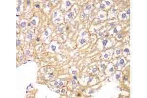 Immunohistochemistry of paraffin-embedded Mouse liver using PPP2R2A Polyclonal Antibody at dilution of 1:100 (40x lens). (PPP2R2A 抗体)