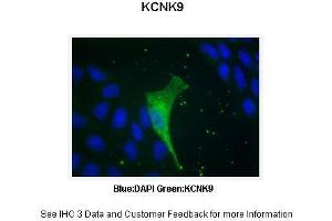 Immunohistochemistry (IHC) image for anti-Potassium Channel, Subfamily K, Member 9 (KCNK9) (N-Term) antibody (ABIN2776216)