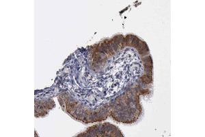 Immunohistochemical staining (Formalin-fixed paraffin-embedded sections) of human fallopian tube shows membranous and cytoplasmic positivity in glandular cells with CRKL polyclonal antibody . (CrkL 抗体  (AA 125-301))