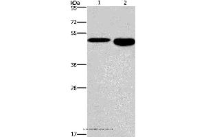 Western blot analysis of Mouse stomach and brain tissue, using DMRT3 Polyclonal Antibody at dilution of 1:550 (DMRT3 抗体)