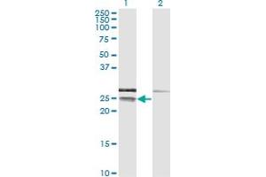 Western Blot analysis of CD99 expression in transfected 293T cell line by CD99 monoclonal antibody (M01), clone 3A10. (CD99 抗体  (AA 23-122))