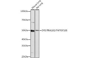 Western blot analysis of extracts of various cell lines, using DR5/TR/TNFRSF10B antibody (ABIN7271062) at 1:1000 dilution.
