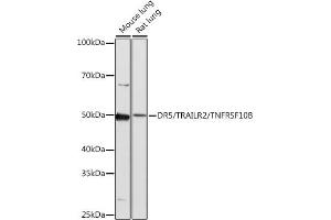 Western blot analysis of extracts of various cell lines, using DR5/TR/TNFRSF10B antibody (ABIN7271062) at 1:1000 dilution. (TNFRSF10B 抗体)