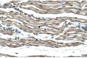 Rabbit Anti-COX15 Antibody  Paraffin Embedded Tissue: Human Muscle Cellular Data: Skeletal muscle cells Antibody Concentration: 4. (COX15 抗体  (N-Term))