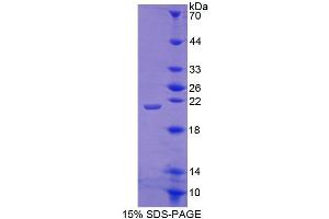 SDS-PAGE analysis of Mouse ACD Protein. (ACD 蛋白)