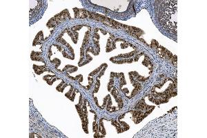 IHC analysis of FOXJ1 using anti-FOXJ1 antibody (ABIN7601015). (FOXJ1 抗体  (AA 27-405))