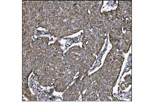 IHC analysis of LRP1B using anti-LRP1B antibody (ABIN7601521). (LRP1B 抗体  (AA 3704-4547))