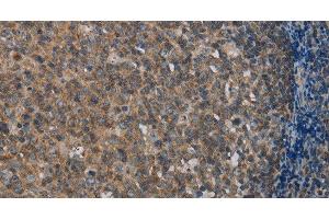 Immunohistochemistry of paraffin-embedded Human tonsil using MMP20 Polyclonal Antibody at dilution of 1:40 (MMP20 抗体)