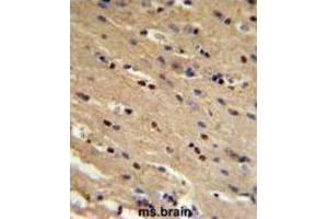 Immunohistochemistry (IHC) image for anti-Tumor Protein P73 (TP73) antibody (ABIN3003949) (Tumor Protein p73 抗体)