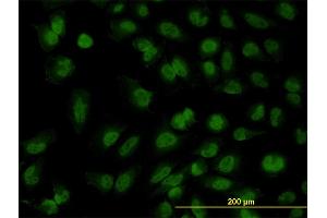 Immunofluorescence of monoclonal antibody to FOXR2 on HeLa cell. (FOXR2 抗体  (AA 1-311))