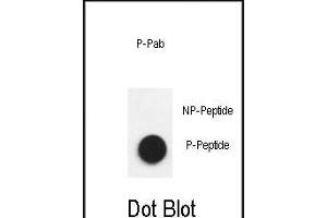 Dot blot analysis of anti-Phospho-Nephrin  antibody Phospho-specific Pab (ABIN650883 and ABIN2839826) on nitrocellulose membrane. (Nephrin 抗体  (pTyr1193))