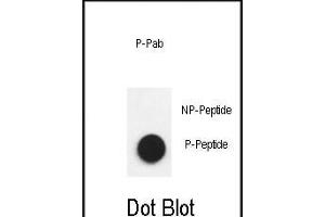 Dot Blot (DB) image for anti-Nephrosis 1, Congenital, Finnish Type (Nephrin) (NPHS1) (pTyr1193) antibody (ABIN650883)