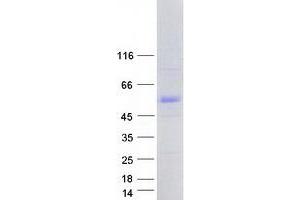 Western Blotting (WB) image for Promyelocytic Leukemia (PML) (Transcript Variant 7) protein (Myc-DYKDDDDK Tag) (ABIN2729210)