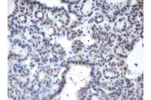 Image no. 1 for anti-Chromobox Homolog 8 (CBX8) (AA 1-260) antibody (ABIN1490660) (CBX8 抗体  (AA 1-260))