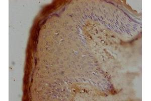 IHC image of ABIN7162249 diluted at 1:100 and staining in paraffin-embedded human skin tissue performed on a Leica BondTM system. (OPTC 抗体  (AA 20-332))