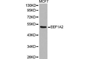 Western blot analysis of extracts of MCF7 cell line, using EEF1A2 antibody. (EEF1A2 抗体)