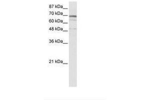 Image no. 1 for anti-Zinc Finger Protein 614 (ZNF614) (AA 56-105) antibody (ABIN6736025) (ZNF614 抗体  (AA 56-105))