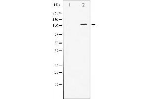 Western blot analysis of STAT2 phosphorylation expression in IFN treated HeLa whole cell lysates,The lane on the left is treated with the antigen-specific peptide. (STAT2 抗体  (pTyr690))
