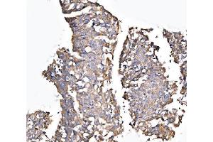 IHC analysis of MLX-interacting protein/MLXIP using anti-MLX-interacting protein/MLXIP antibody (ABIN7602593).