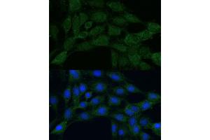 Immunofluorescence (IF) image for anti-Methylenetetrahydrofolate Dehydrogenase (NADP+ Dependent) 2, Methenyltetrahydrofolate Cyclohydrolase (MTHFD2) (AA 40-250) antibody (ABIN6144144)
