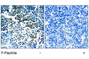 Image no. 1 for anti-Breakpoint Cluster Region (BCR) (pTyr177) antibody (ABIN196938) (BCR 抗体  (pTyr177))