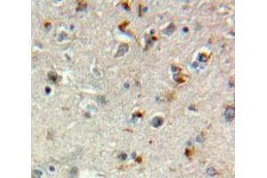 Used in DAB staining on fromalin fixed paraffin-embedded Brain tissue (TGFBR3 抗体  (AA 469-724))