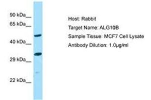 Image no. 1 for anti-Asparagine-Linked Glycosylation 10, alpha-1,2-Glucosyltransferase Homolog B (ALG10B) (AA 179-228) antibody (ABIN6750149) (ALG10B 抗体  (AA 179-228))