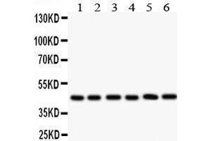 Anti- IL2RA antibody, Western blotting All lanes: Anti IL2RA  at 0. (CD25 抗体  (N-Term))