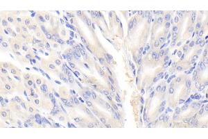 Detection of EIF2aK3 in Mouse Stomach Tissue using Polyclonal Antibody to Eukaryotic Translation Initiation Factor 2 Alpha Kinase 3 (EIF2aK3)