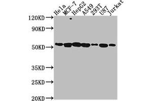 Western Blot Positive WB detected in: Hela whole cell lysate, MCF-7 whole cell lysate, HepG2 whole cell lysate, A549 whole cell lysate, 293T whole cell lysate, U87 whole cell lysate, Jurkat whole cell lysate All lanes: PRAMEF6 antibody at 1:2000 Secondary Goat polyclonal to rabbit IgG at 1/50000 dilution Predicted band size: 55 kDa Observed band size: 55 kDa (PRAMEF6 抗体  (AA 209-476))