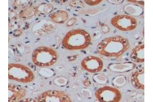 Detection of MGMT in Human Kidney Tissue using Polyclonal Antibody to O-6-Methylguanine DNA Methyltransferase (MGMT) (MGMT 抗体  (AA 1-207))