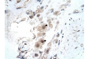 KIAA0494 antibody was used for immunohistochemistry at a concentration of 4-8 ug/ml to stain Decidual cells (arrows) in Human Placenta. (KIAA0494 抗体  (N-Term))