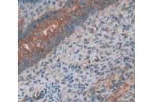 IHC-P analysis of Kidney tissue, with DAB staining. (PLAP 抗体  (AA 68-313))