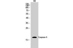 Western Blotting (WB) image for anti-Caspase 3 (CASP3) (Ser1981) antibody (ABIN3183667) (Caspase 3 抗体  (Ser1981))