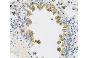 Immunohistochemistry of paraffin-embedded Mouse lung using RSPO1 Polyclonal Antibody at dilution of 1:100 (40x lens). (RSPO1 抗体)