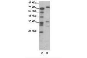 Image no. 1 for anti-CAMP Responsive Element Binding Protein 3 (CREB3) (AA 247-296) antibody (ABIN6736064) (CREB3 抗体  (AA 247-296))
