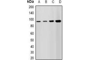 Western blot analysis of Lsh expression in A549 (A), HepG2 (B), mouse spleen (C), rat testis (D) whole cell lysates. (SLC11A1 抗体)