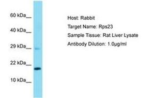 Image no. 1 for anti-Ribosomal Protein S23 (RPS23) (AA 15-64) antibody (ABIN6750515) (RPS23 抗体  (AA 15-64))