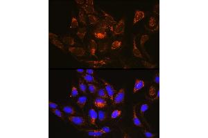Immunofluorescence analysis of U-2 OS cells using R Rabbit pAb (ABIN6128425, ABIN6146547, ABIN6146548 and ABIN6214868) at dilution of 1:100 (40x lens). (RAB13 抗体  (AA 1-203))