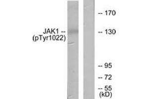 Western blot analysis of extracts from A549 cells , using JAK1 (Phospho-Tyr1022) Antibody. (JAK1 抗体  (pTyr1022))