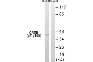 Western Blotting (WB) image for anti-cAMP Responsive Element Binding Protein 1 (CREB1) (pThr100) antibody (ABIN1847546) (CREB1 抗体  (pThr100))