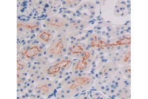 Used in DAB staining on fromalin fixed paraffin- embedded Kidney tissue (ALOX15B 抗体  (AA 349-633))