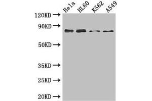 Western Blot Positive WB detected in: Hela whole cell lysate, HL60 whole cell lysate, K562 whole cell lysate, A549 whole cell lysate All lanes: SSRP1 antibody at 3. (SSRP1 抗体  (AA 1-242))